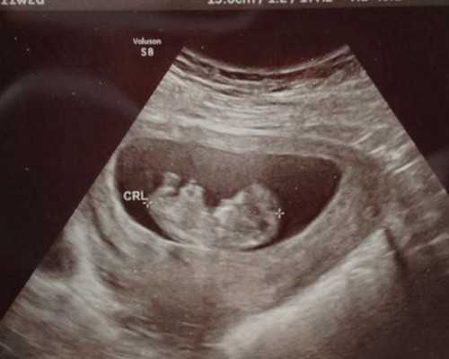 古玩虫电视剧免费土豆全集在线,哑铃多重适合增肌？