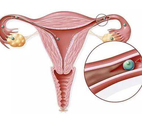 香港验血一天出结果,【香港化验所】怀孕能不能吃草鱼