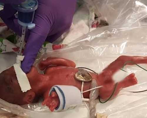 香港验血测男女翻盘,三个月能查性别吗_给大家分享我的真实经历