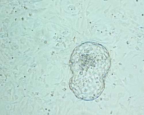 香港验血机构哪家靠谱？宝妈亲身经历分享,怀孕香港验血晚上抽血可以吗