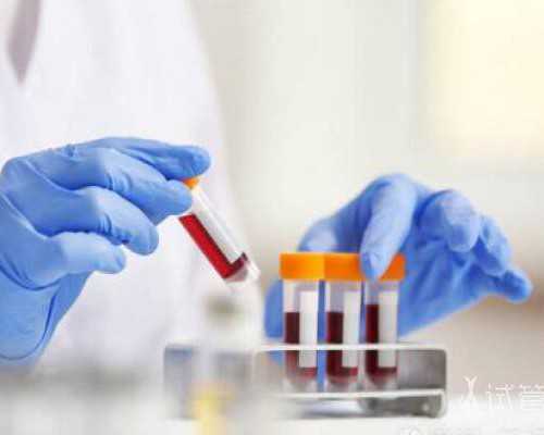 验血女孩打胎是男孩的那些事（备孕吧）,香港验血是胎龄还是孕龄