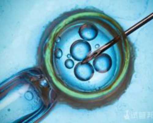 古玩鉴定交易买卖平台,技术专栏丨iOS中Log同步获取与重定向