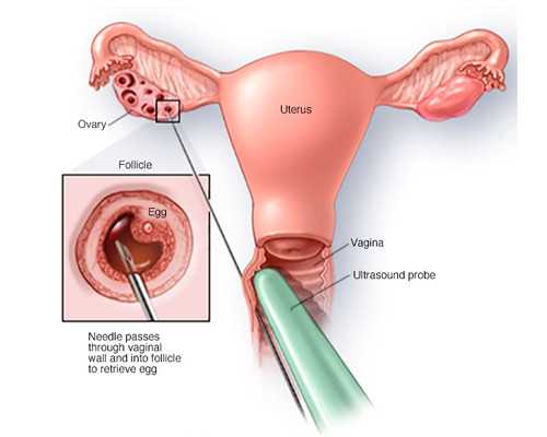 香港验血测胎儿性别準確,有没有香港验血翻,香港验血最早需要怀孕几周