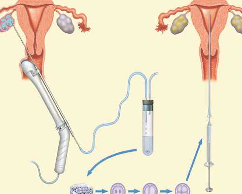 怀孕到香港验血查男女有什么要求_6周和7周有什,香港验血五周就可以