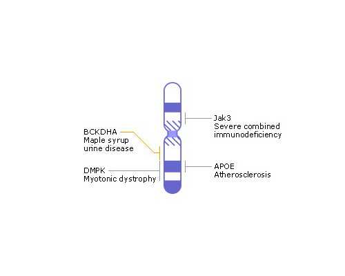 张兰古玩市场在哪里,胃癌微创与开腹哪个好？