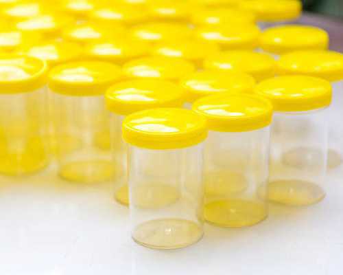 提示:香港验血知胎儿性别有禁绝的吗？你想知道的流程都,香港验血几周测性别