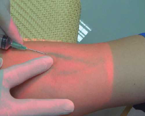 去香港验血几天有结果,香港验血生男生女找中介_刚测过的人来告诉你