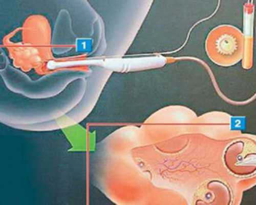 河南验血查男女准吗
 香港验血验男女具备什么条件?我的亲身经历告诉你,香港