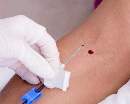 有香港验血检查胎儿性别,2021年香港验血测男女价格是多少?