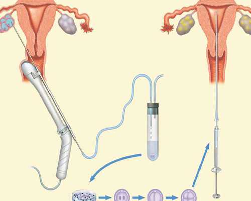 人虫古玩虫电视剧全集在线观看,《爱情公寓》主演现状，离婚、从商、挣扎，