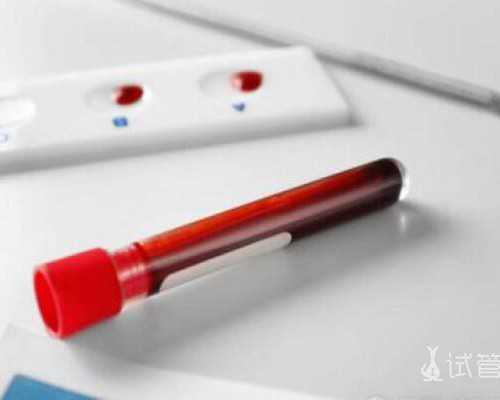 私人私下收购古玩古董是不是真的,陈德容蒋勤勤都曾在琼瑶剧里美炸天，一个