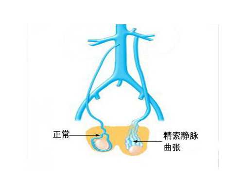 澳门收藏家协会古玩上门收购,男人如何减肥 这方法得看看