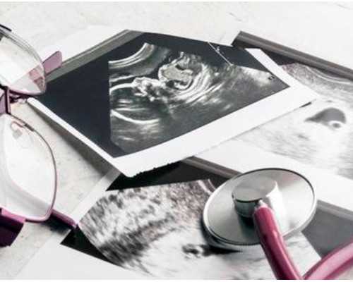 古玩行大掌柜 小说,半月板损伤的诊断方法