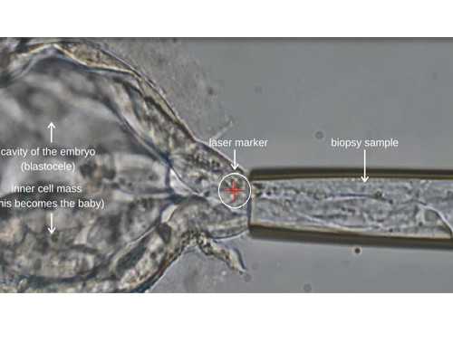 怀孕初期能不能吃零食,怀孕6周香港验血