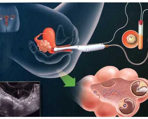香港验血邮寄血液时间规定,寄血到香港查男女会有不准吗,采血鉴定性别需要什