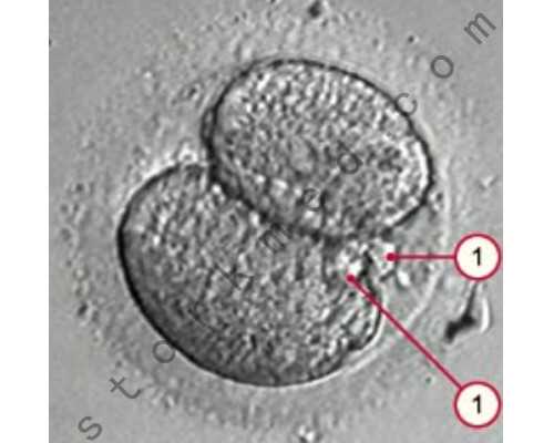 香港验血是6周还是7周,香港验血什么时候预约_验血查性别化验所哪家准!