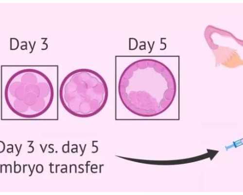 想要了解宝宝性别 妊娠线判断准确吗,香港验血为什么要等7周